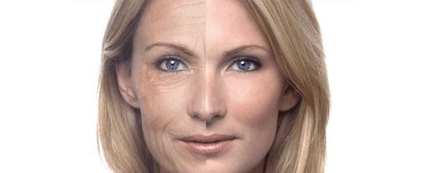 Introduction to Phytoceramides